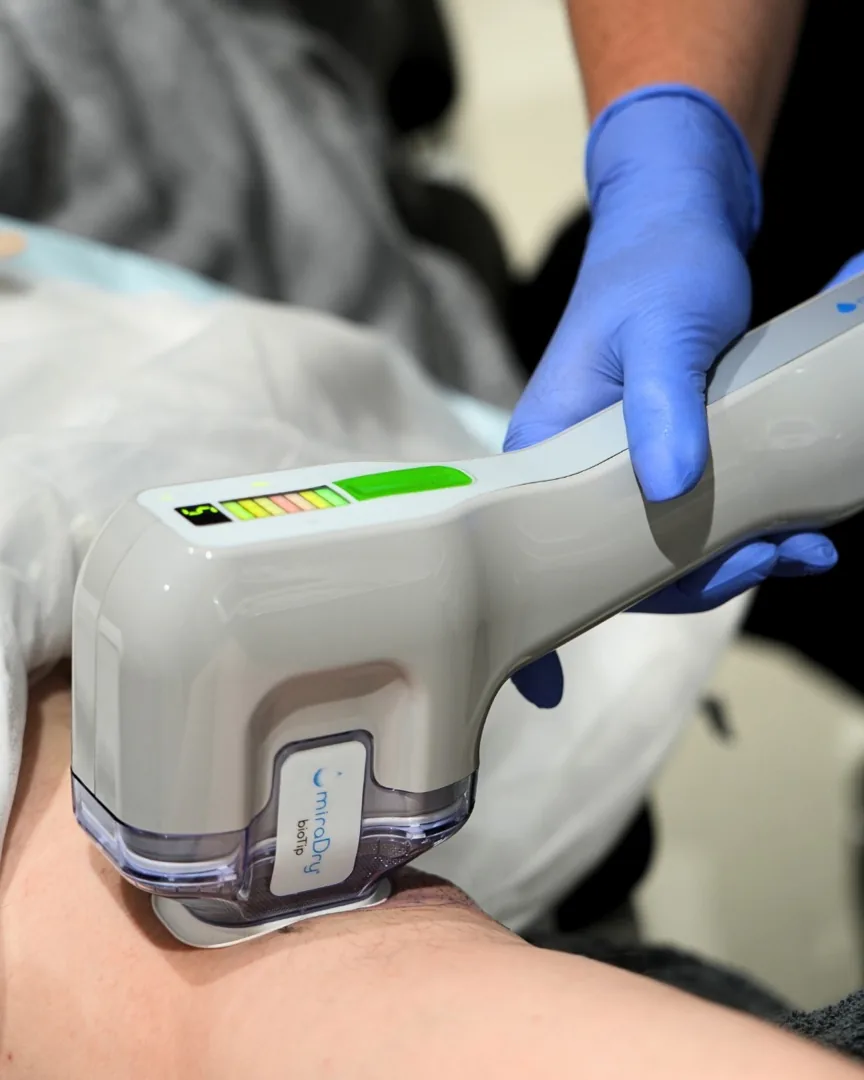 Das miraDry-Handstück wird unter der Achsel einer Patientin angesetzt